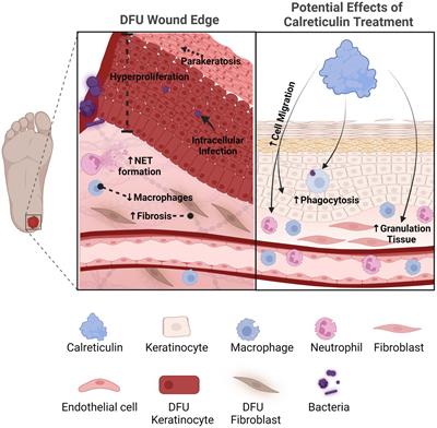 Calreticulin: a multifunctional protein with potential therapeutic applications for chronic wounds